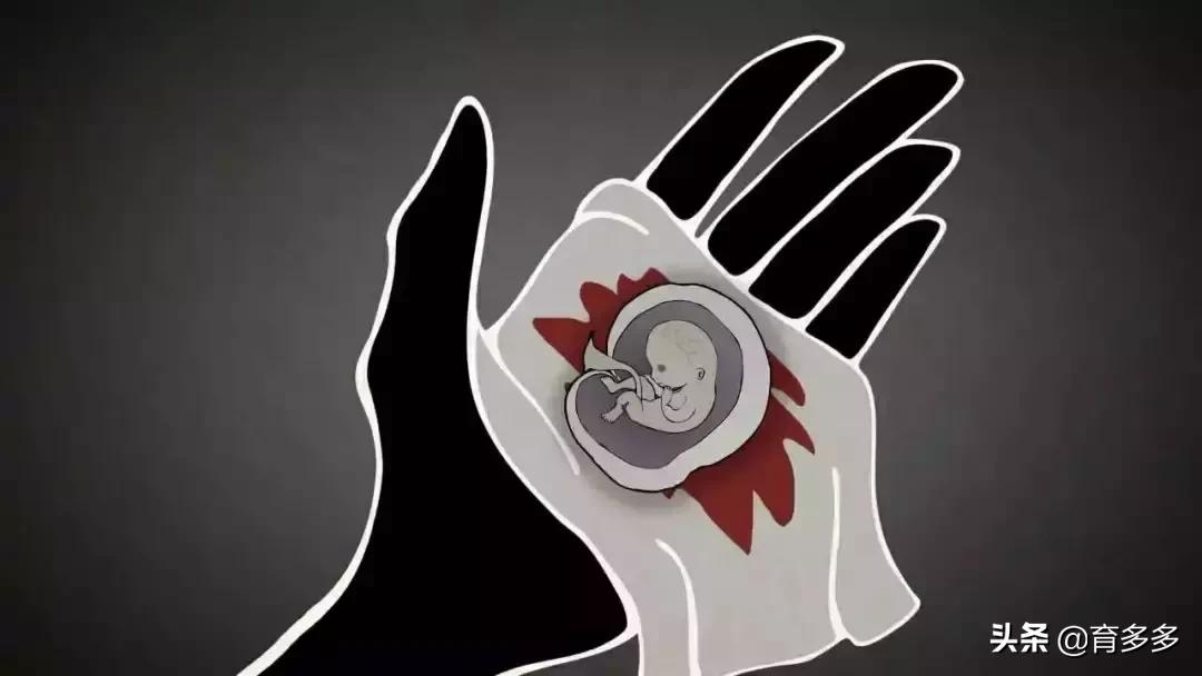 为什么那么多人避孕失败,中国十大避孕失败案例