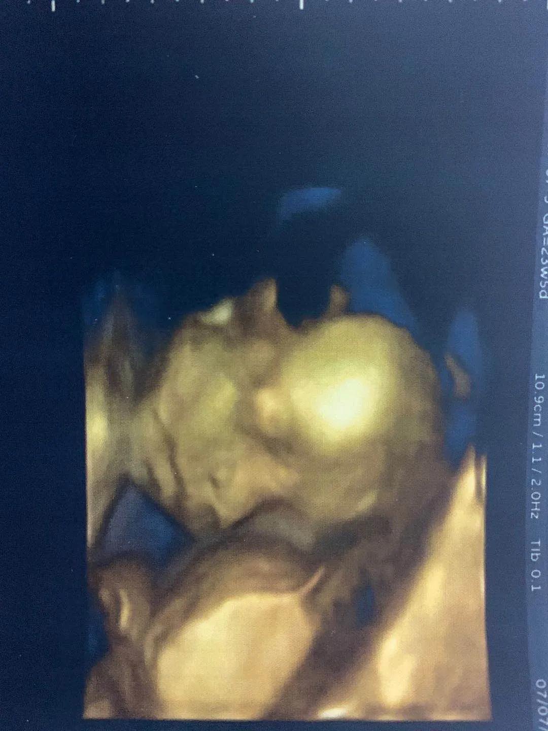 孕中期孕晚期如何度过