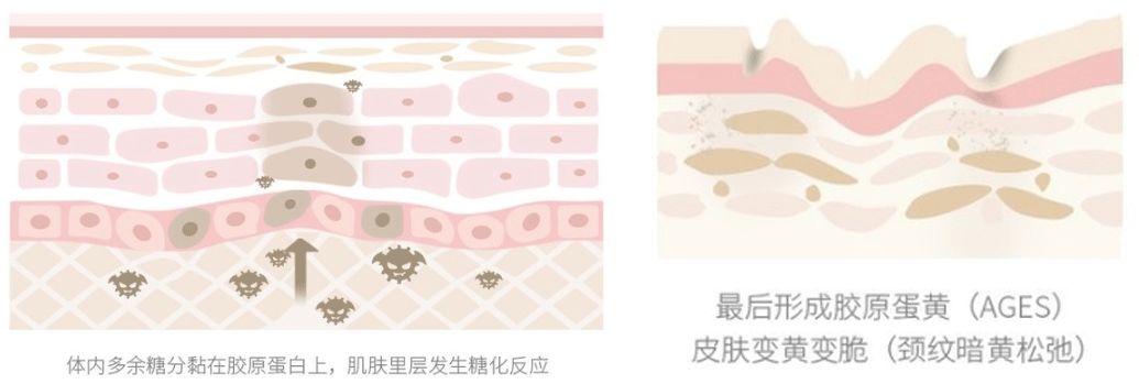 有颈纹和没有颈纹的女人,女人有颈纹怎么办