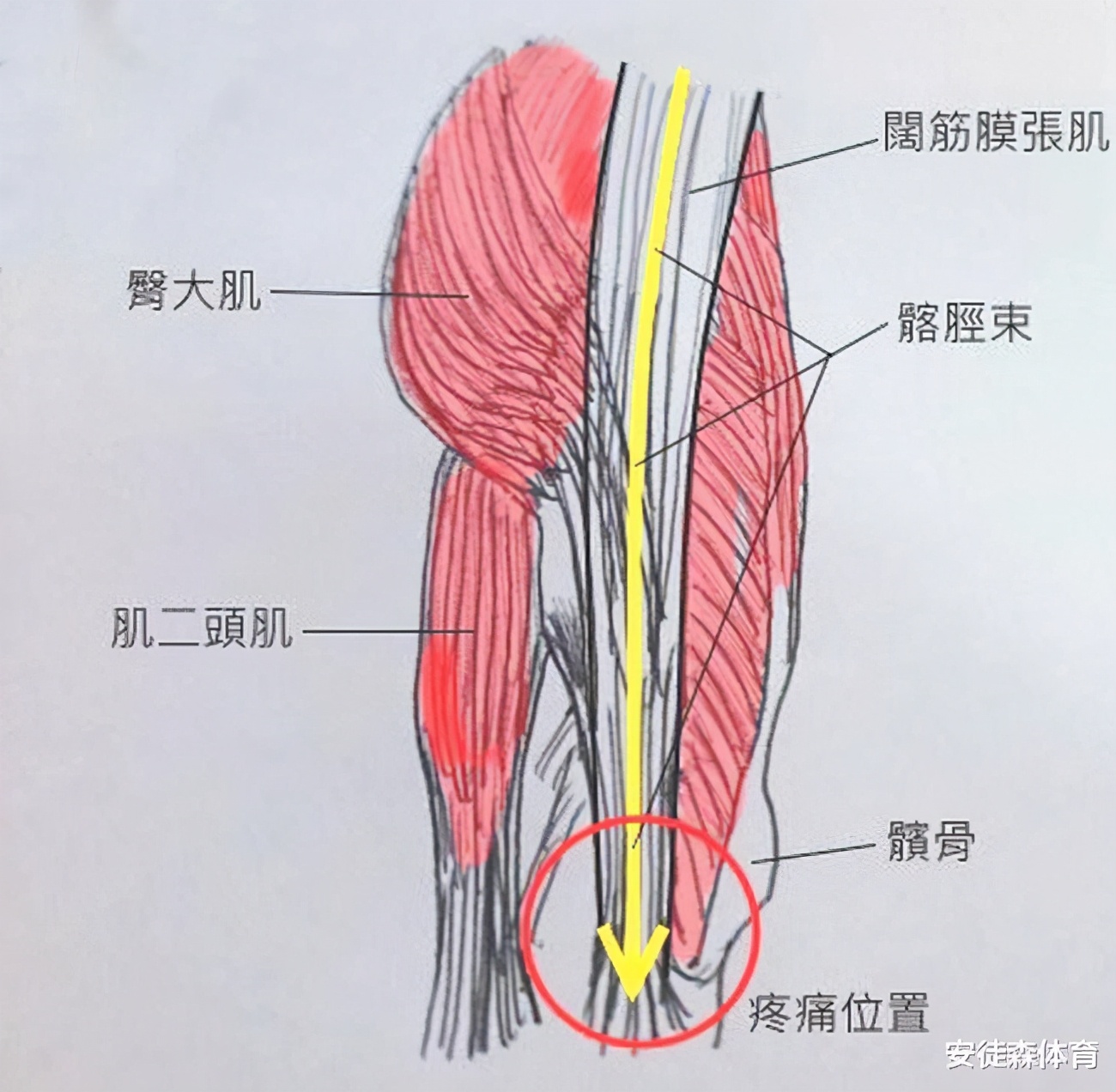 膝盖外侧痛的锻炼方法,膝盖外侧痛怎么贴肌肉贴