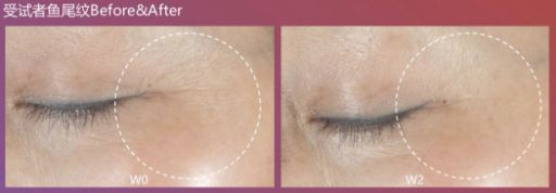 哪款美容仪才不是智商税,美容仪应不应该买