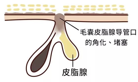 洁面仪值得买吗,洁面仪高端