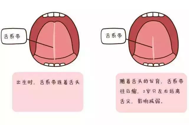 孩子发音不准吐字不清什么原因,小孩说话发音不准确怎么纠正