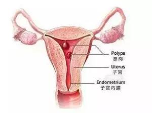 多年不孕容易长子宫肌瘤,多年不孕怎么找原因