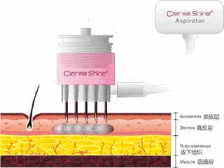 科普|光子嫩肤全攻略，做了光子后禁忌事项有哪些？