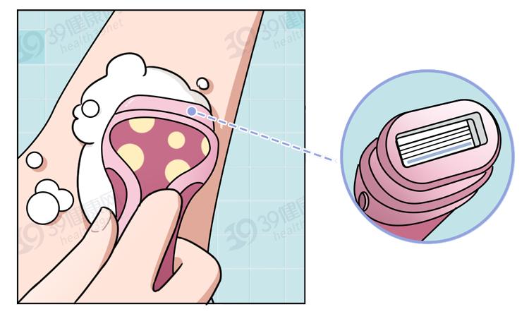 女生的腋毛都是怎么处理的,女生的腋毛重是什么原因