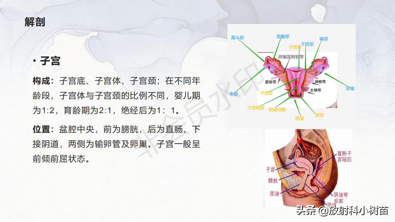 女性盆腔mri解剖图谱,泌尿生殖系统x线解剖