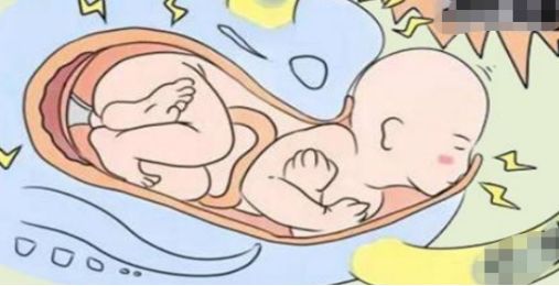 怀孕33周孕妇突然临产，调度员电话指导分娩，突遭临产要注意什么