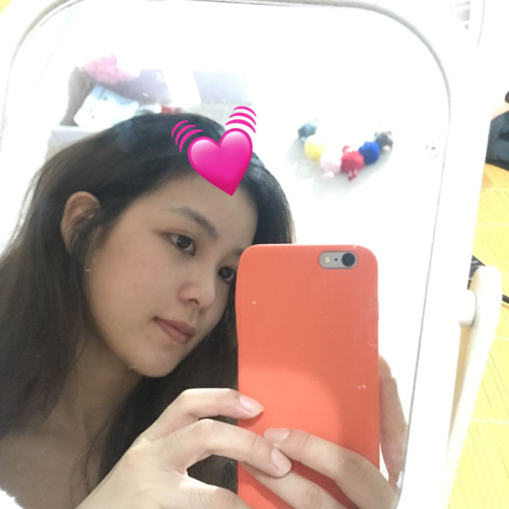 你们的痘痘最后都是怎么完全好的？反正我是用了这个方法才好的