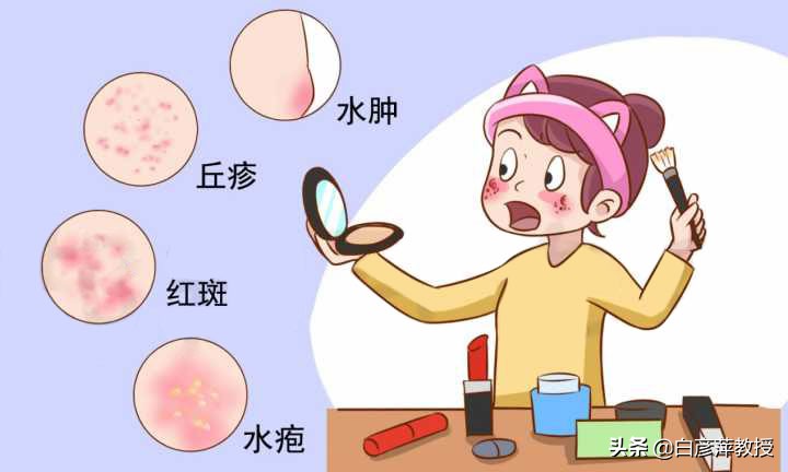 护肤品过敏脸部红肿起白疹子,红斑最简单自愈方法
