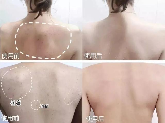 洗澡搓出来的泥每天都可以洗,洗澡搓出来的泥增多了