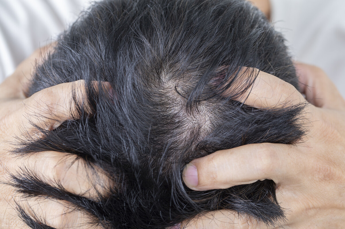 如何判断自己是痘痘还是毛囊炎,长痘痘一般是毛囊炎还有什么