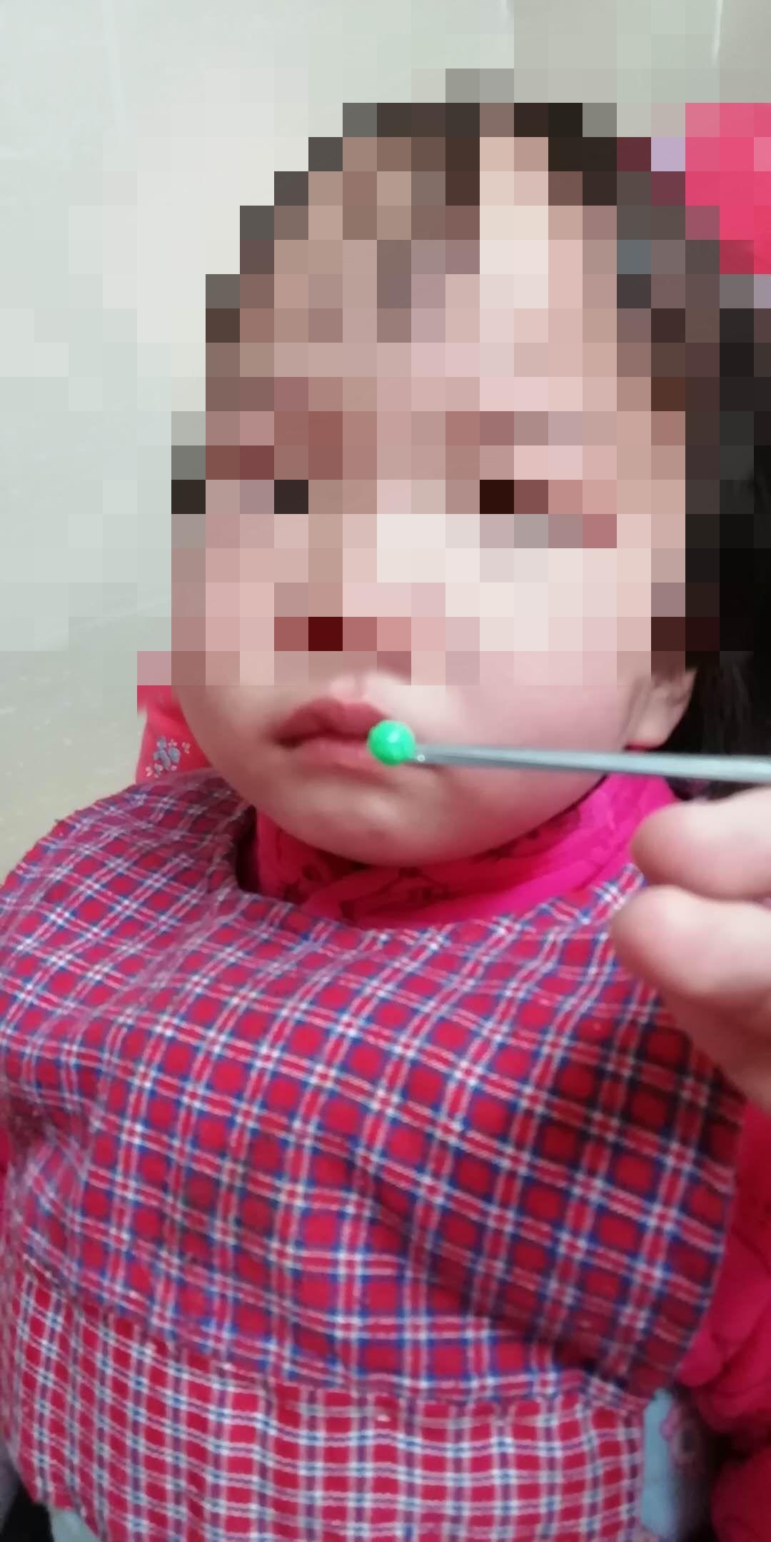 家长注意！徐州多名孩子鼻孔里出现了*珠钢**、西瓜、橡皮泥……
