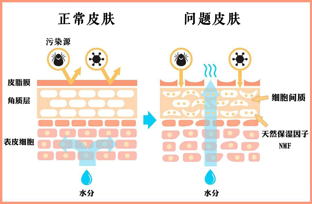 长痘总是反反复复怎么办,解决反复长痘方法