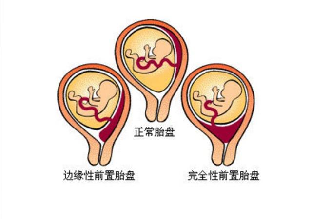 孕期可以吃辣椒吗,孕期能吃辣椒吗