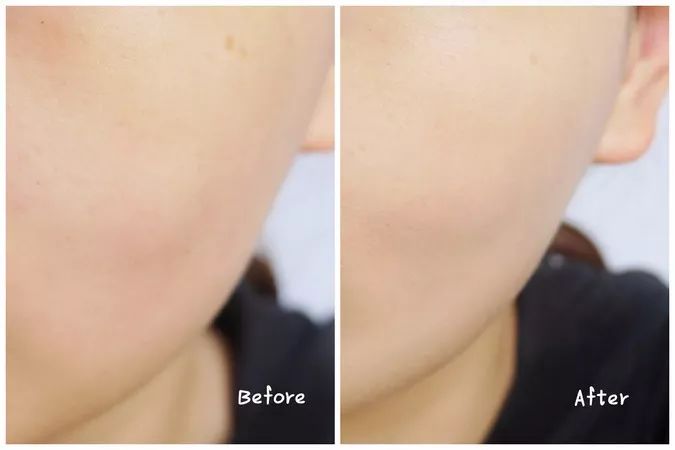 olay和欧莱雅哪个值得购买,欧莱雅和olay哪个性价比高