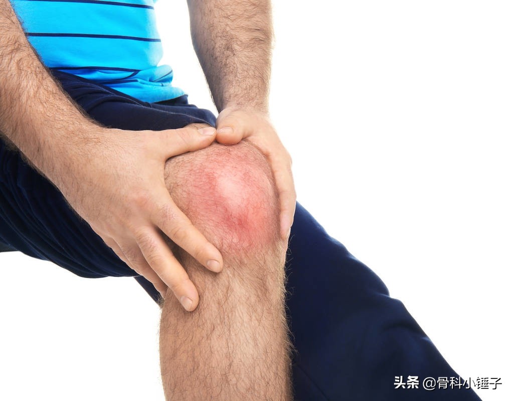 骨折有哪些后遗症,脚后跟粉碎性骨折会留下后遗症吗