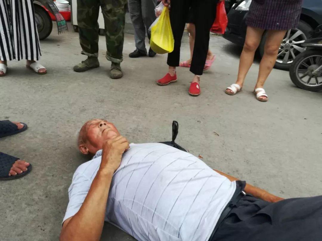 撞到人轻微事故怎么处理,撞到头怎么处理