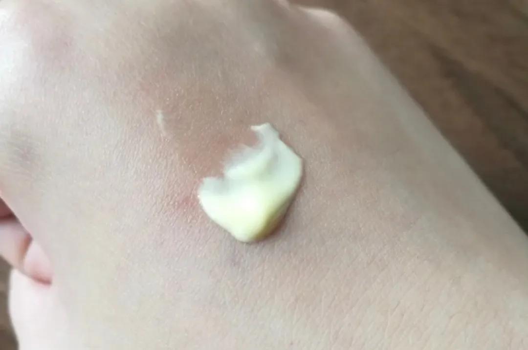 黑眼圈越来越重怎么搞定黑眼圈,简单有效缓解黑眼圈的两个小方法