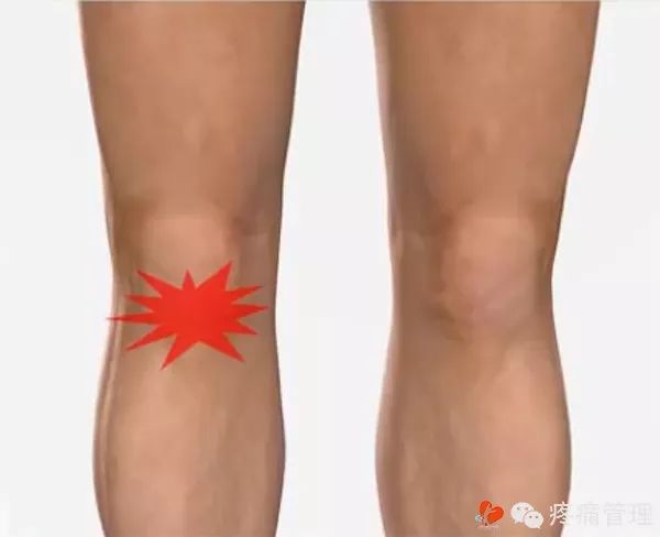 膝盖卡卡的怎么办,膝盖咔咔响疼痛怎么办