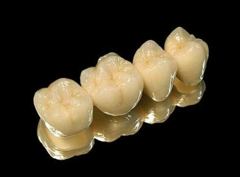 各种假牙价格一览表,假牙十大品牌价格表