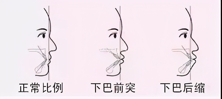 什么样的下巴才是最好看的,什么样的下巴是丰满的