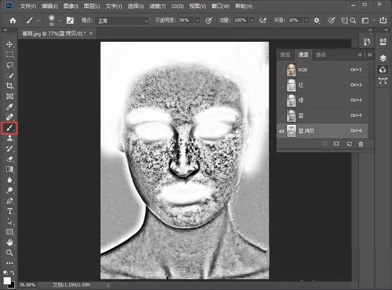 祛除脸部雀斑最有效的方法,有什么日常方法可以去除脸上雀斑