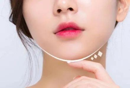 假体垫下巴后会出现位移变形吗？