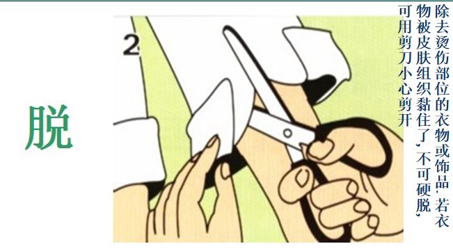 孩子烫伤记住5个字,牢记五字口诀轻松处理宝宝烫伤