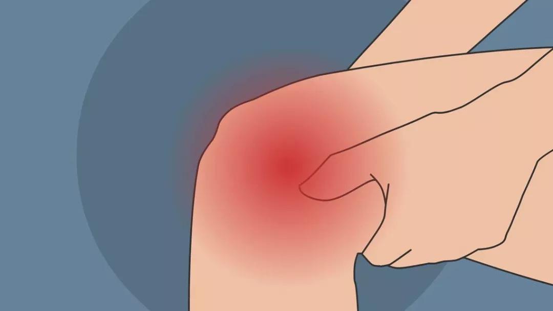 类风湿性关节炎和老寒腿一样么,老寒腿风湿关节炎