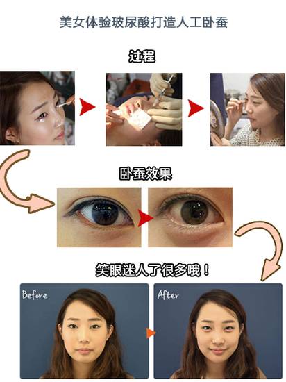 导致衰老的是哪个器官,导致衰老的原因