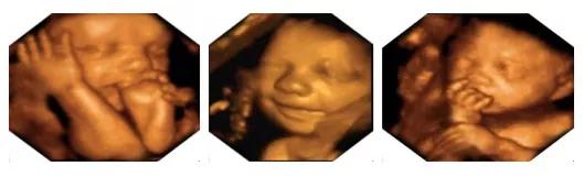 孕期超声检查须知,准妈妈必读产前超声小课堂