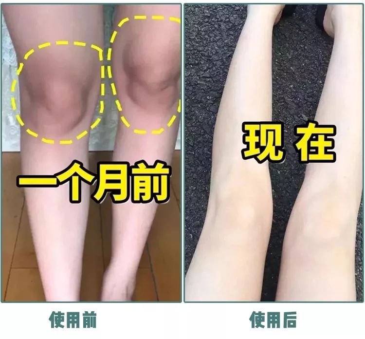 张韶涵护肤三周养皮,燕窝水漾嫩肤精华面膜包文婧