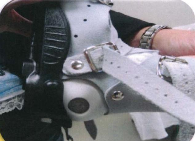 马蹄内翻足的护理有哪些呢,马蹄足内翻矫正支具