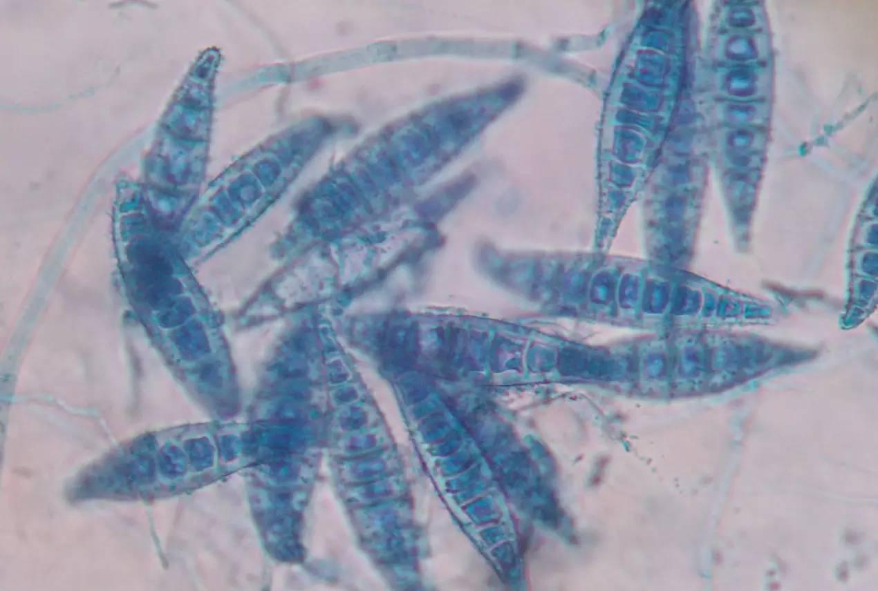 养猫孩子长猫癣什么原因,人得了猫癣怎么养猫