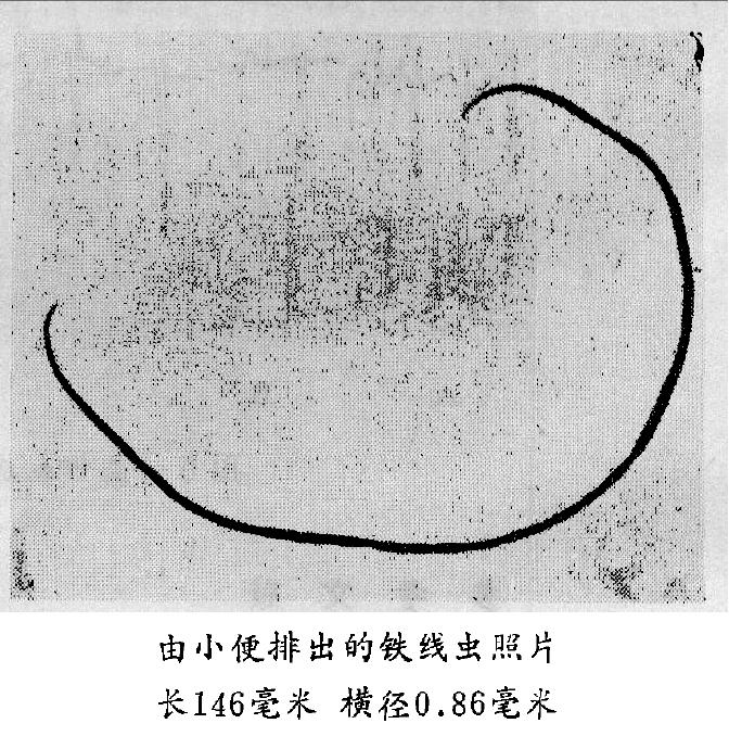 铁线虫来袭,能操纵螳螂“自杀”的寄生虫,能否控制人类?