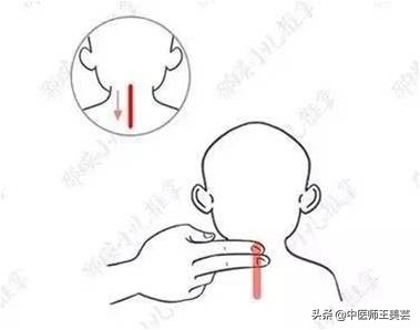 孩子发烧出疹子怎么办,孩子发烧大便不通该怎么办