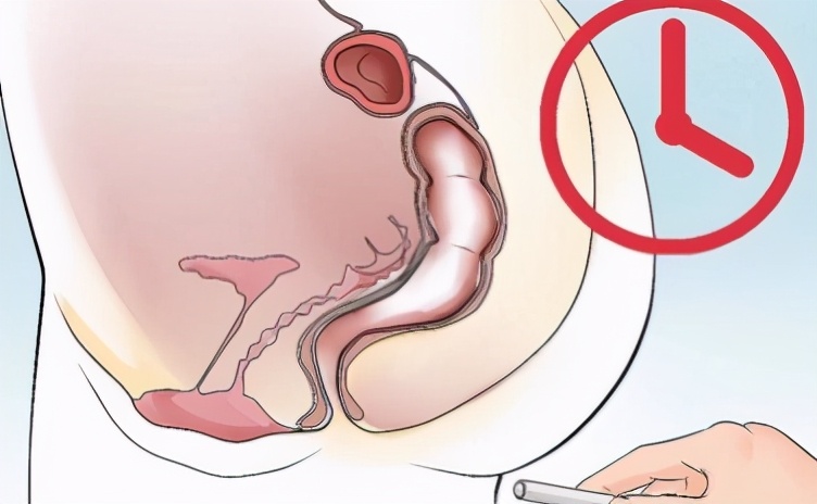 急性肛裂是怎么回事,肛裂出血会导致重度贫血吗