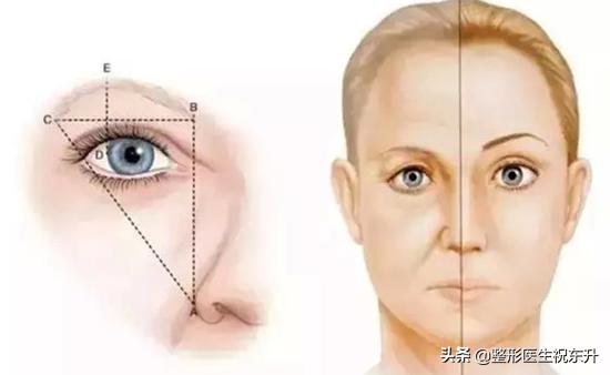 眉上内窥镜提眉视频全过程,内镜提眉