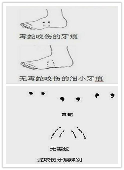 别慌，遇到蛇咬伤要这样处置！