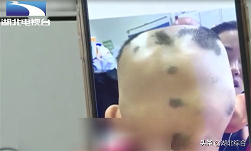 最简单有效的生发秘方,苗家秘方生发