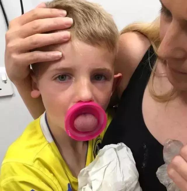 孩子舌头被饮料瓶困住,小孩喝水舌头被卡杯盖