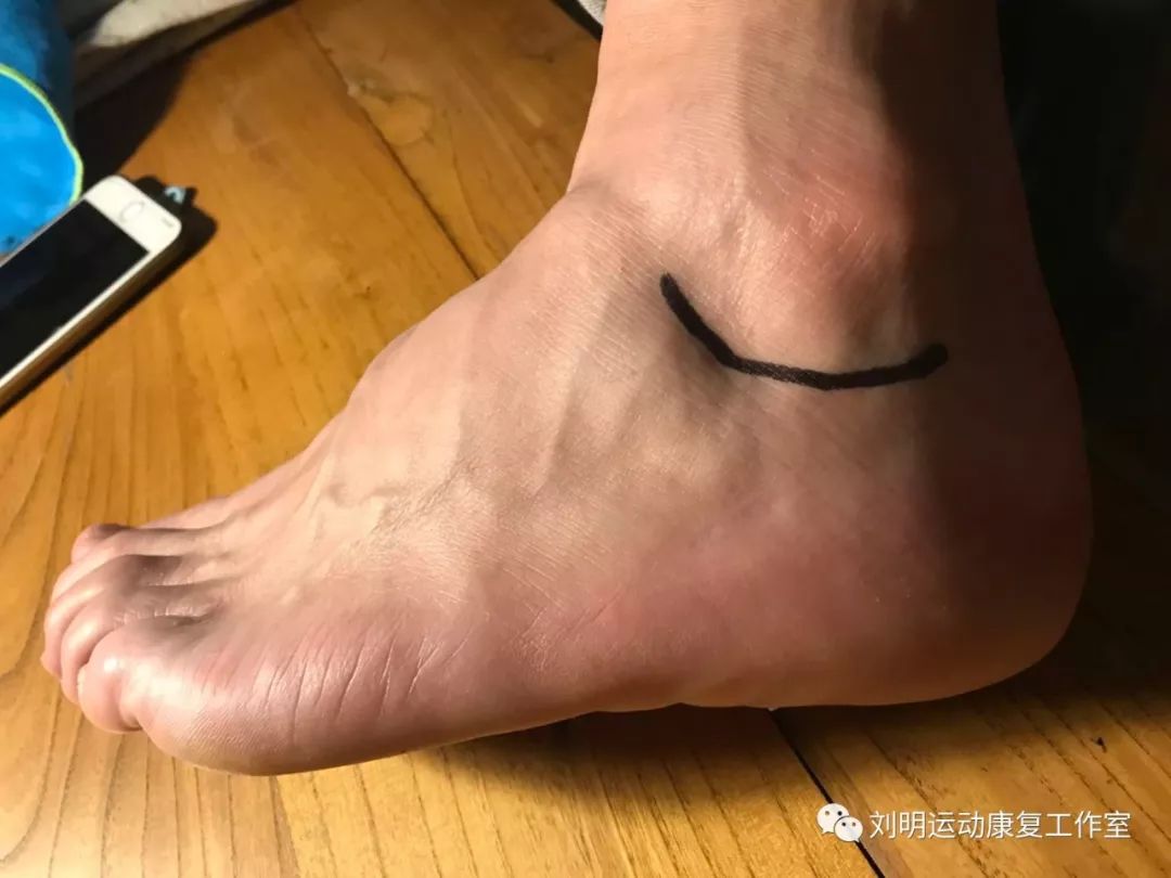 跑步是高级运动么,跑步真的有技术吗