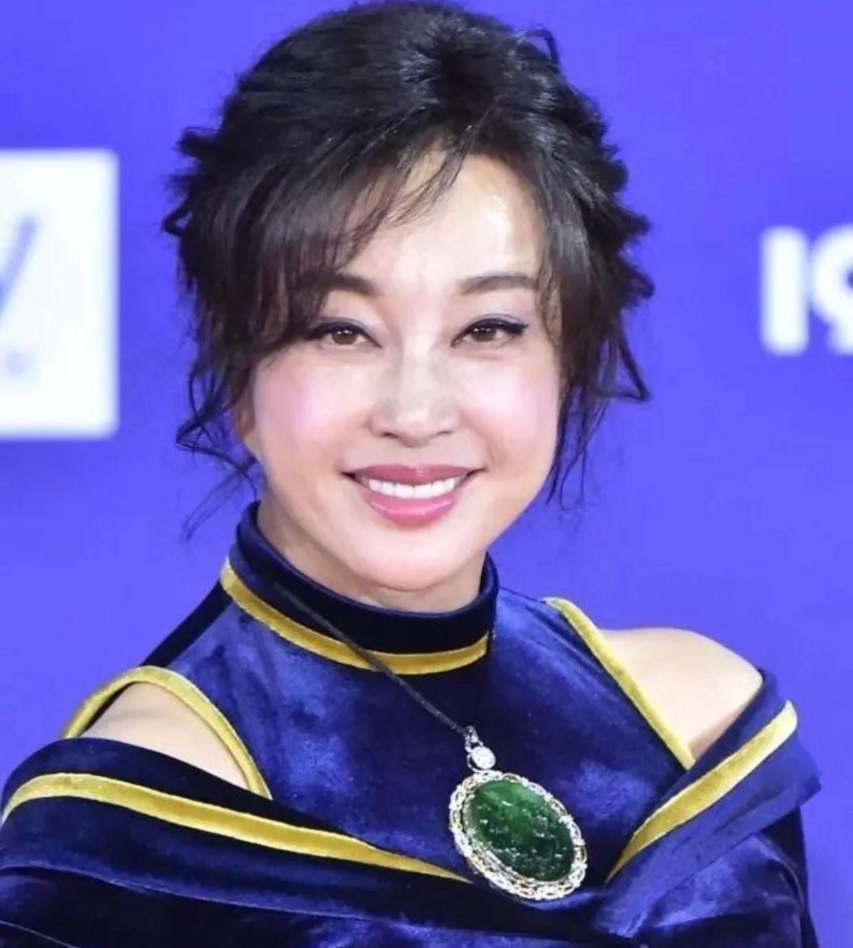 明星整容和不整容老去有什么区别,自然老去和整容明星的对比