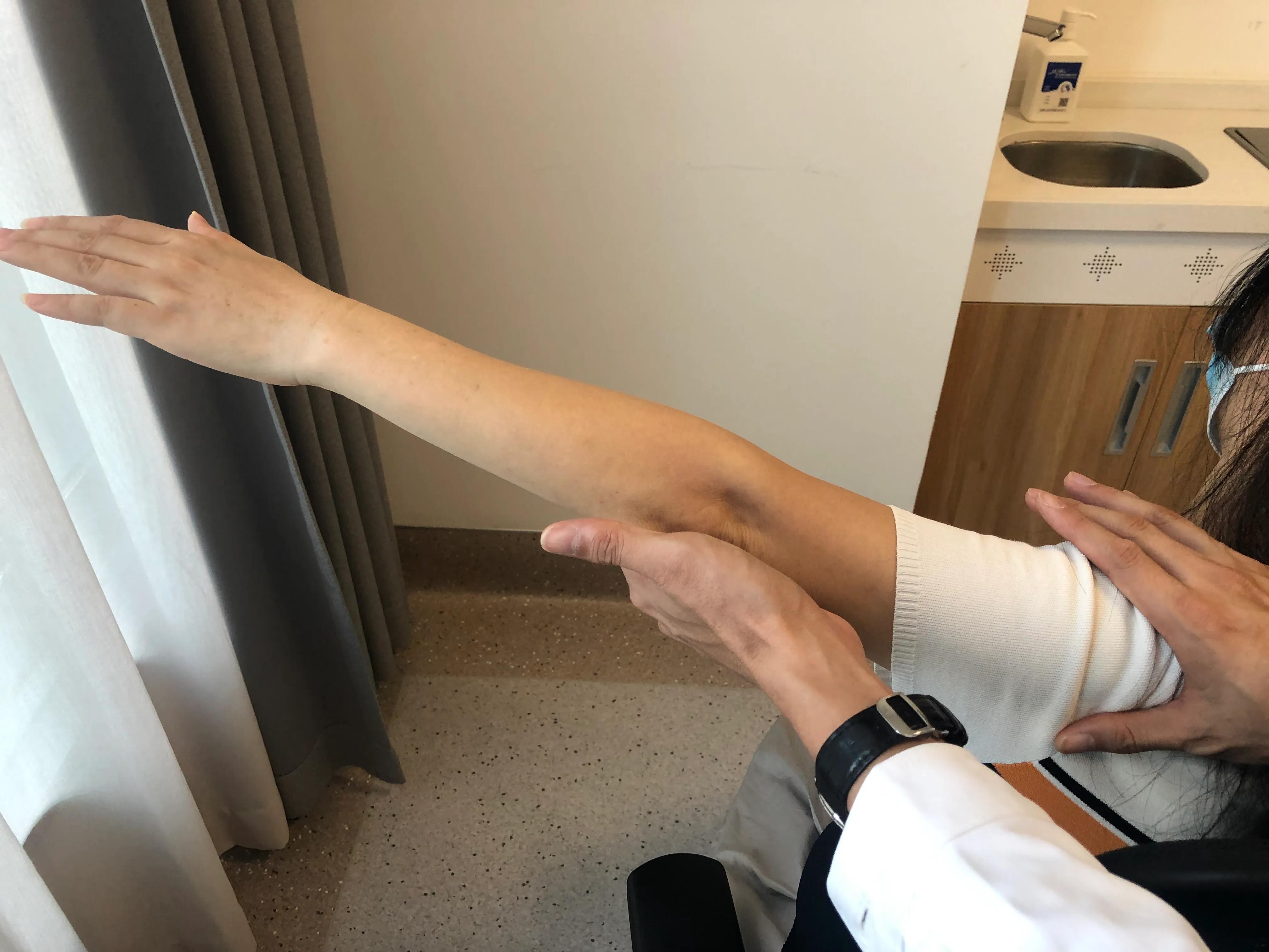 贴药膏过敏了过一个星期能治好吗,贴膏药过敏了怎么办最快方法