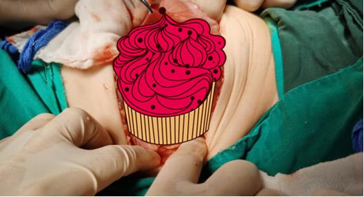 4岁小孩得肾母细胞肿瘤,什么样的宝宝容易得肾母细胞瘤