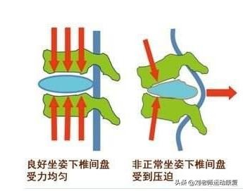 腰疼、腰突患者自我康复新疗法《牵引复位训练》,恢复腰椎功能