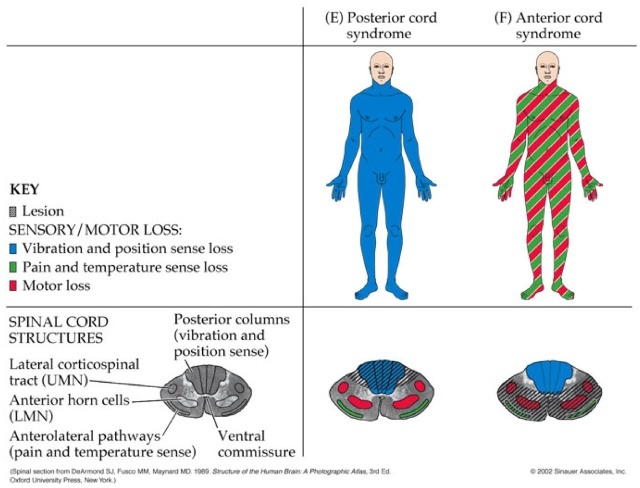 脊髓的解剖学,脊髓的解剖结构手绘图