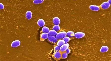 粪链球菌强在哪？一起来看个究竟