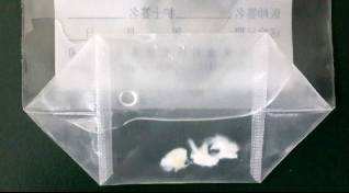 半月板缝合后复查核磁形态失常,半月板术后复查显示撕裂